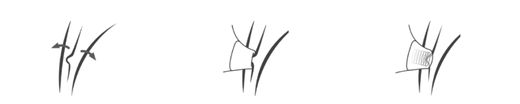 womanizer stimulatie