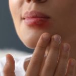is koortslip herpes